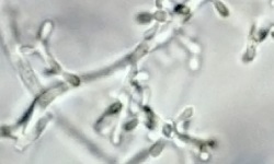 Trichophyton rubrum